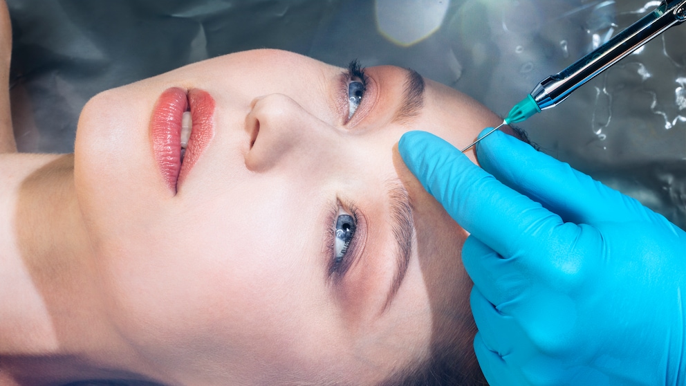 Botox-Behandlung