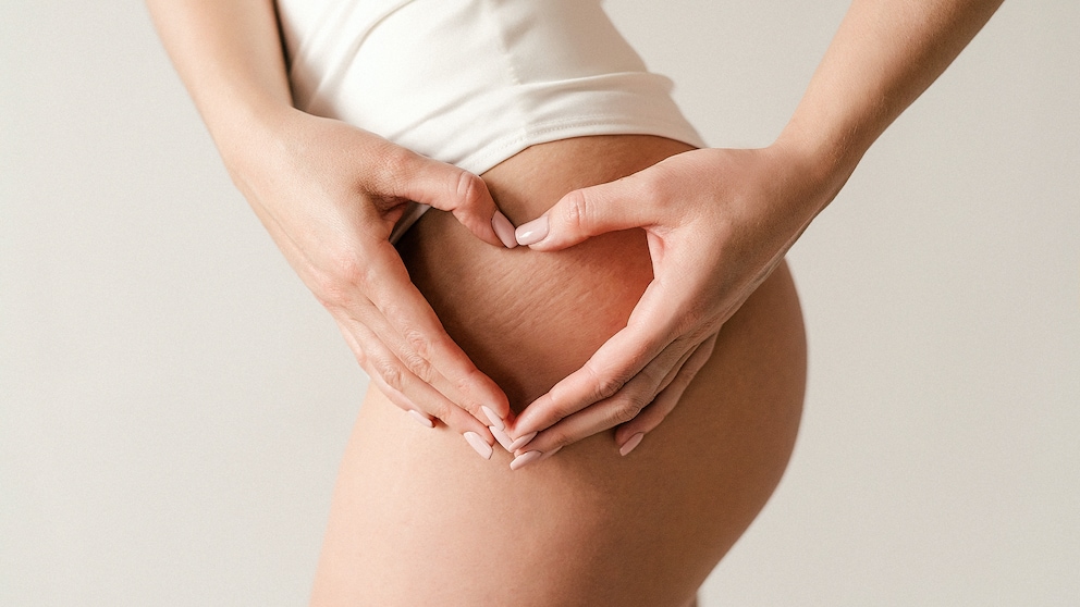 Frau, die ihre Cellulite am Bein zeigt
