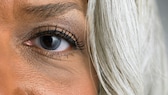 Frau im Close-up mit dunklen Augenringen