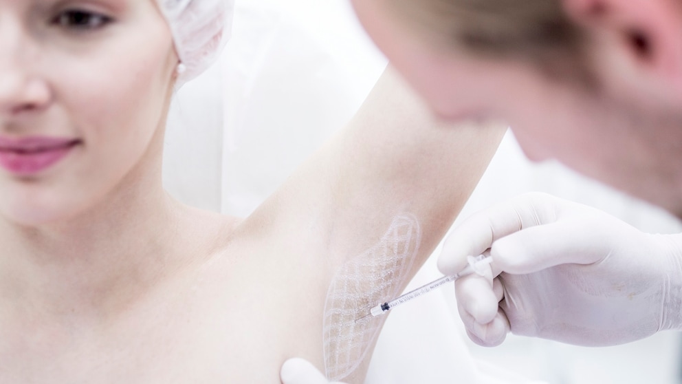 Botox gegen Schwitzen