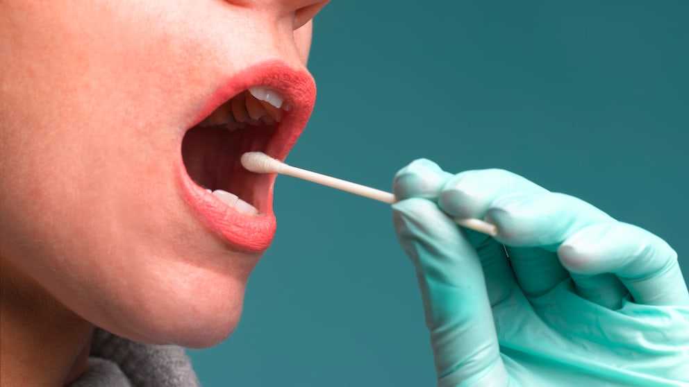 Speicheltest zur Bestimmung von Endometriose
