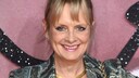 Twiggy spricht über Schönheitsoperationen, Botox und Filler