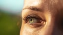 Was hilft, wenn die Wimpern ausfallen?