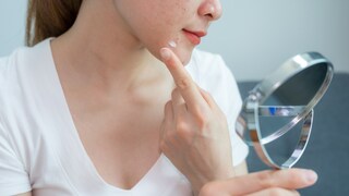Ob eine spezielle Diät gegen Akne hilft? STYLEBOOK hat nachgefragt!