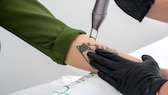 Zum Glück kann man peinliche Tattoo-Patzer heutzutage mit einem Laser entfernen – allerdings nicht immer problemlos