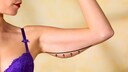 „Body Contouring“ ist der neueste Schrei unter den Beauty-OPS