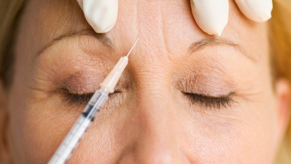 Botox wirkt nicht, was nun?