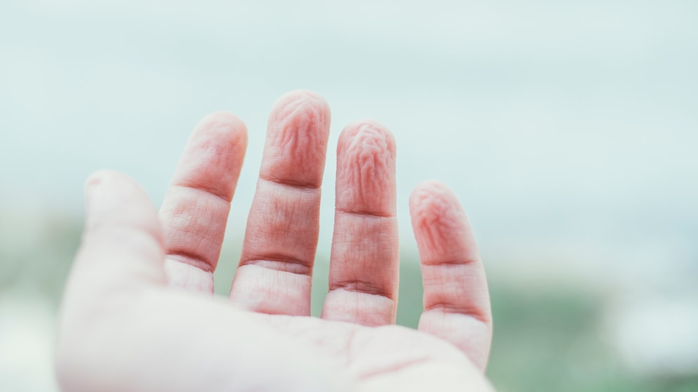 Wenn die Finger zu lange im Wasser sind, kann es sein, dass sie schrumpeln