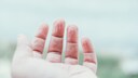 Wenn die Finger zu lange im Wasser sind, kann es sein, dass sie schrumpeln