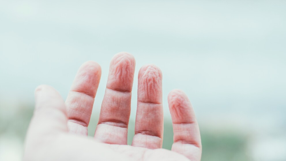 Wenn die Finger zu lange im Wasser sind, kann es sein, dass sie schrumpeln