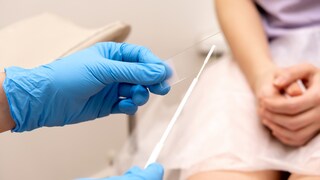 The gynecologist puts a smear on a slide glass for microscopy, hands close-up.Diagnosis of diseases of the genitourinary system.Women's health, medical concept.Selective focus.