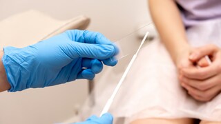 The gynecologist puts a smear on a slide glass for microscopy, hands close-up.Diagnosis of diseases of the genitourinary system.Women's health, medical concept.Selective focus.