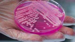 Bacteria growing in petri dish in lab
