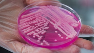 Bacteria growing in petri dish in lab