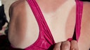 Sonnenbrand vorbeugen