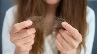 Gegen Haarausfall soll Aminexil wirken – doch was kann der Wirkstoff von L’Oréal?