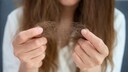 Gegen Haarausfall soll Aminexil wirken – doch was kann der Wirkstoff von L’Oréal?