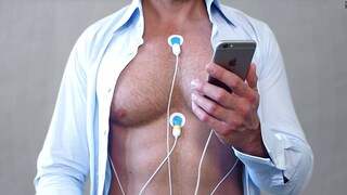Cardiosecur: Diese App soll vor einem Herzinfarkt schützen