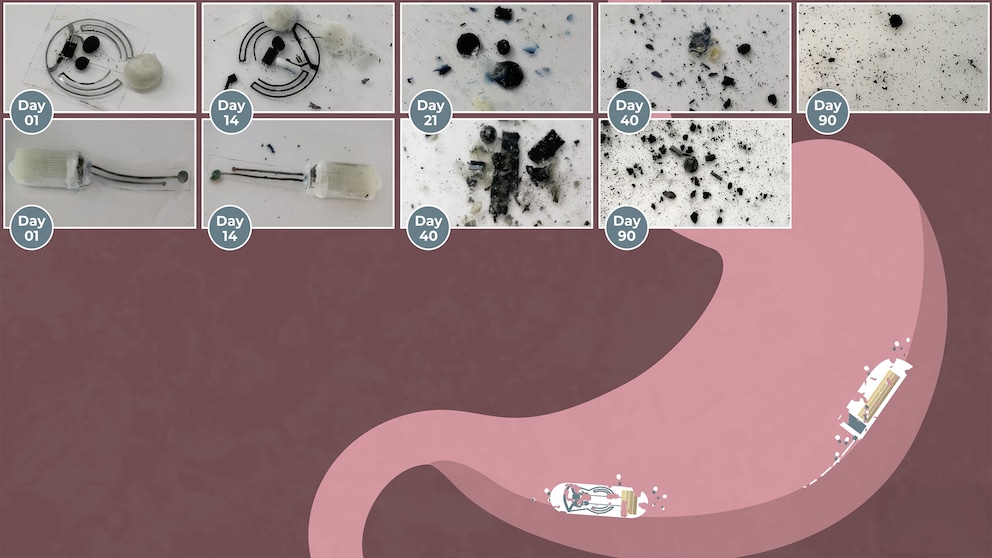 Graphic shows the gradual decay of two electronic components. Photos document the condition on days 1, 14, 21, 40, and 90. In the background, a stomach with two capsules is schematically depicted.