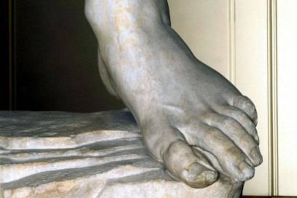 Der linke Fußknöchel des „David“ weist winzige Frakturen auf