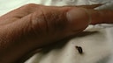 Wer sich unfreiwillig Zimmer und Bett mit Bettwanzen teilt, hat meist am nächsten Morgen juckende Bisse am Körper