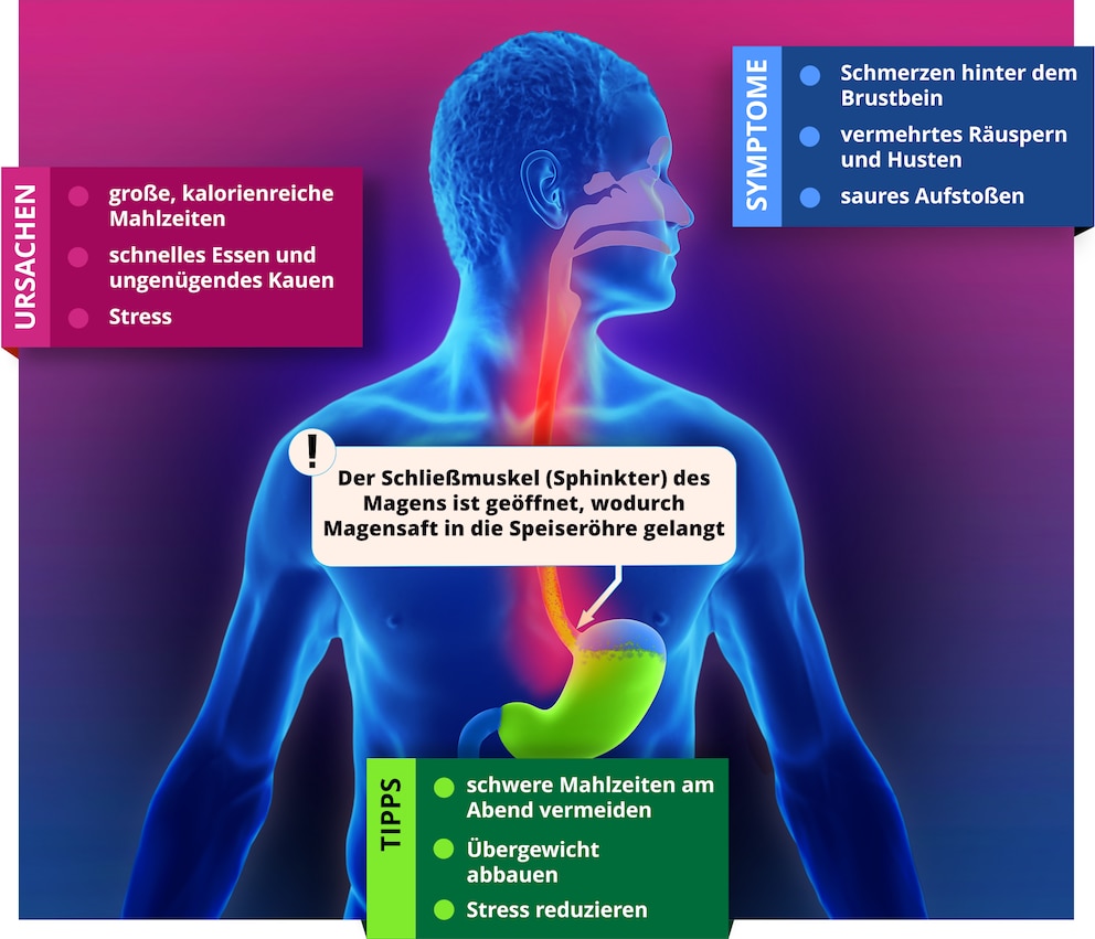 Informationsbild zu Sodbrennen